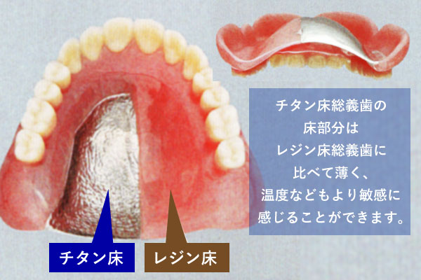 チタン床総義歯の床部分はレジン床総義歯に比べて薄く、温度などもより敏感に感じることができます。